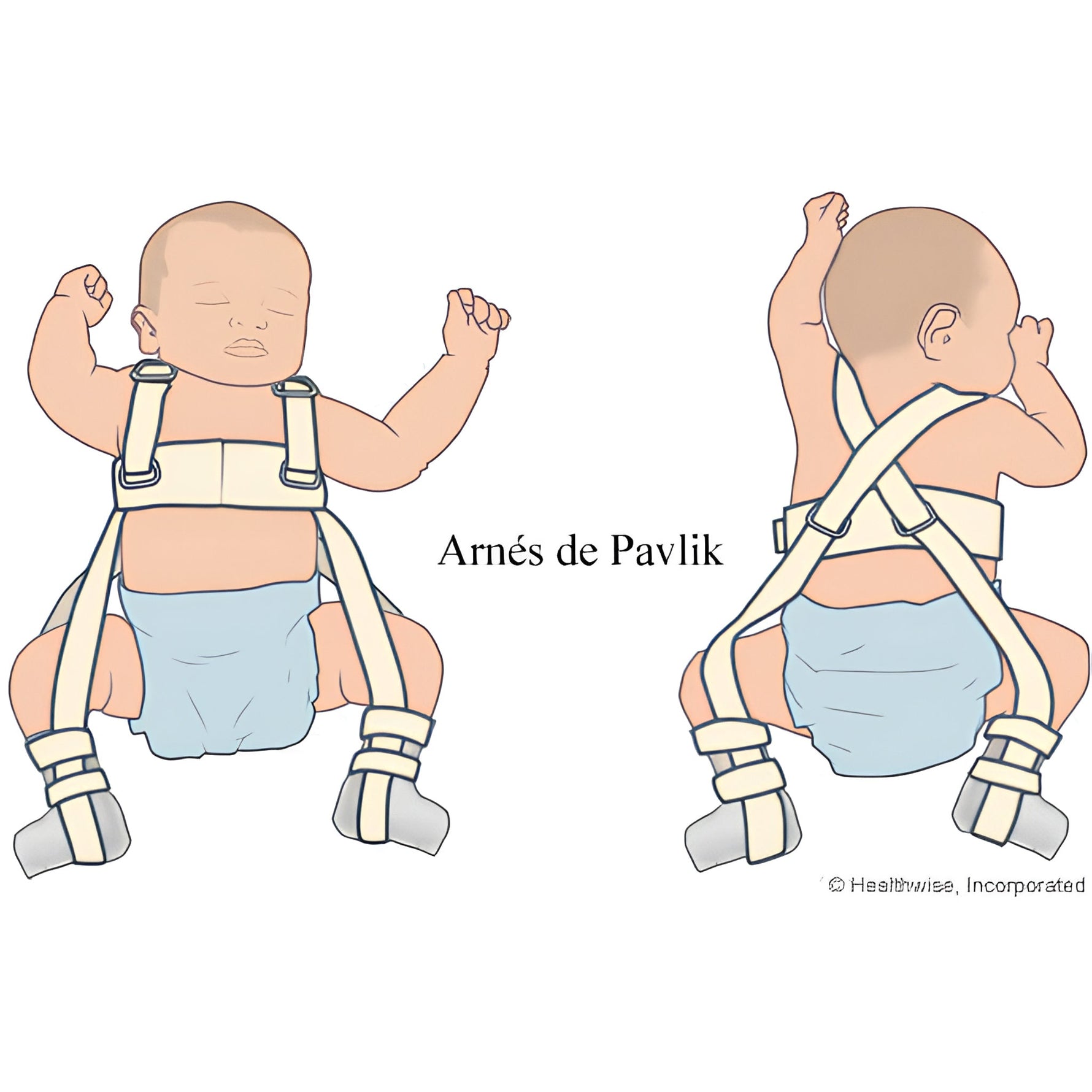 Arnés Pavlik Pediátrico
